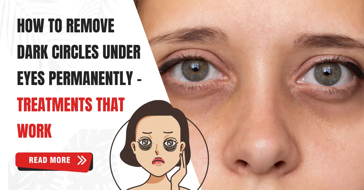 How to remove dark circles under eyes permanently