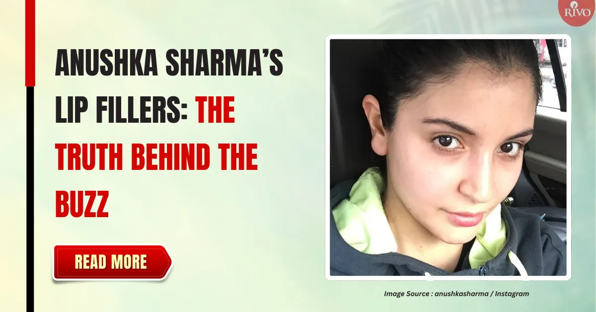 anushka-sharma-lip-fillers-truth