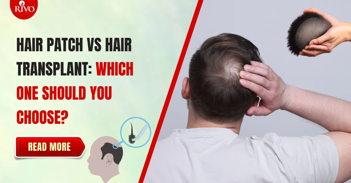 hair-patch-vs-hair-transplant