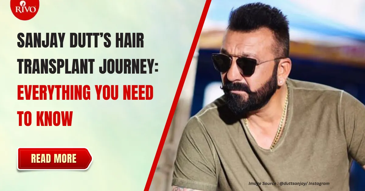 sanjay-dutt-hair-transplant