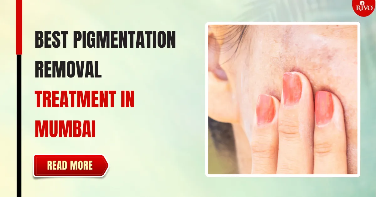 best-pigmentation-removal-treatment