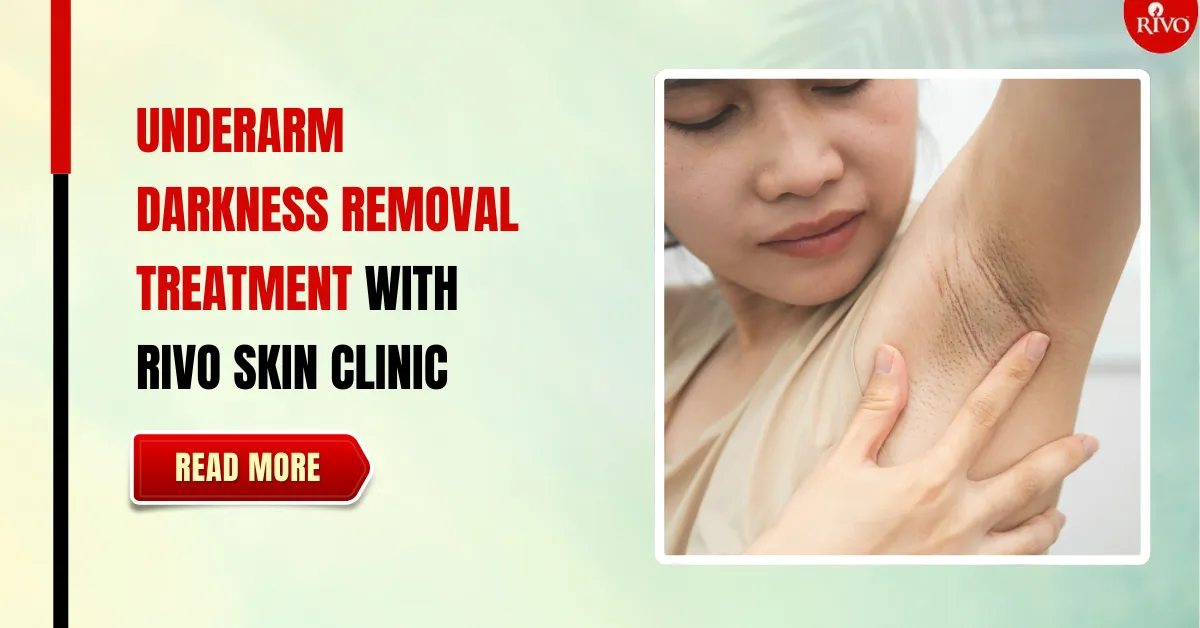 underarm-darkness-removal-treatment