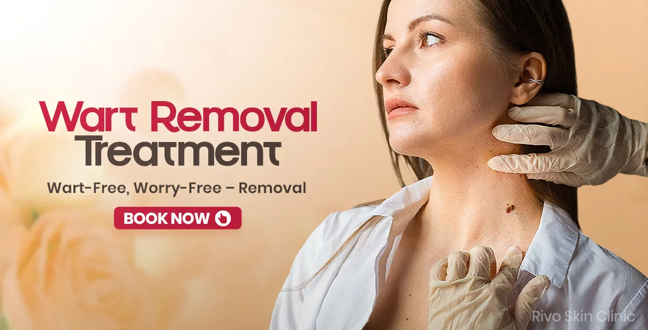 Wart Removal - Banner
