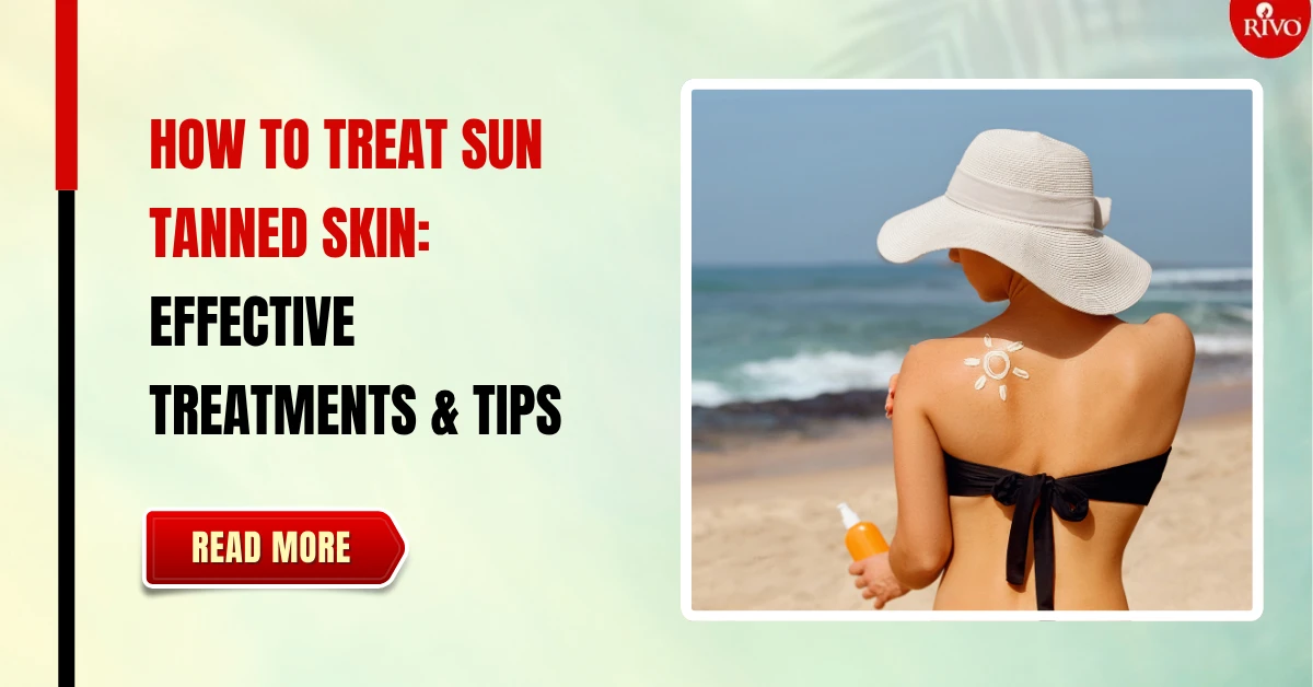 How to Treat Sun Tanned Skin