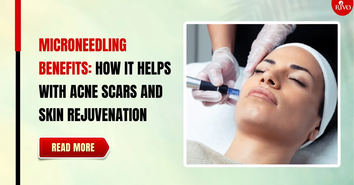 microneedling benefits