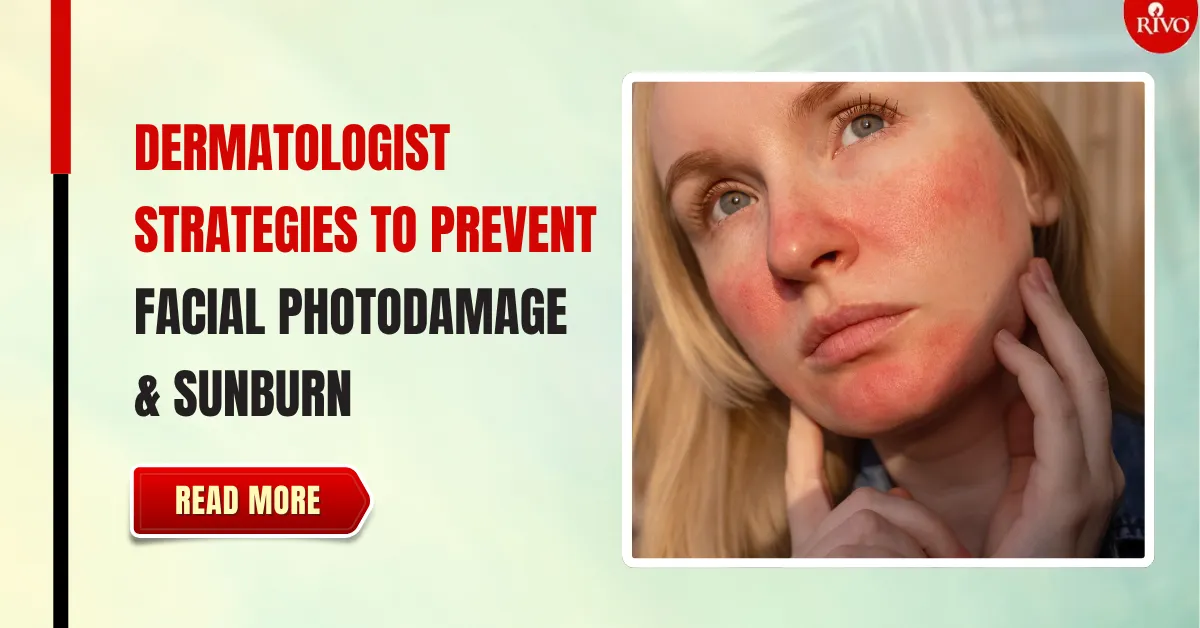 how to prevent sunburn on face