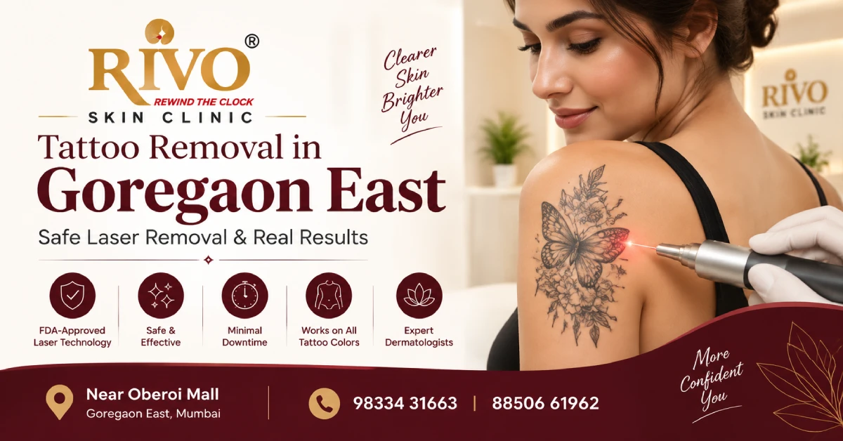 Tattoo Removal in Goregaon East