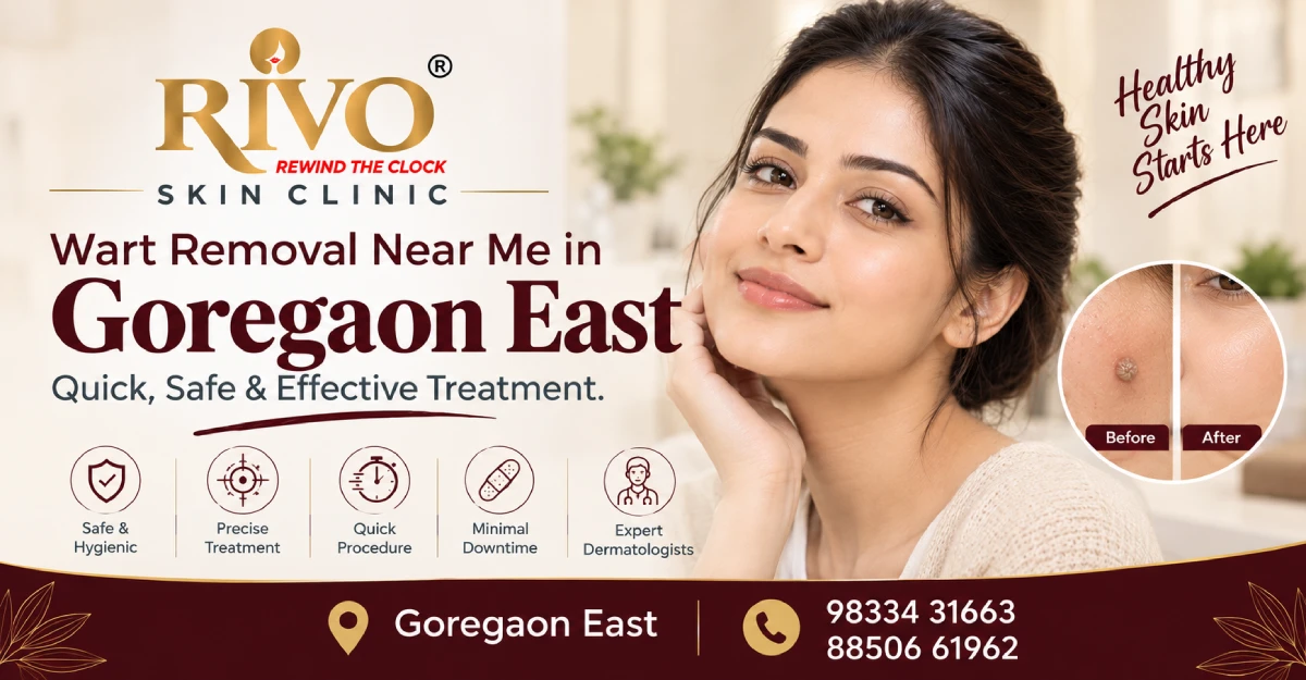 Wart Removal Near Me Goregaon Eas