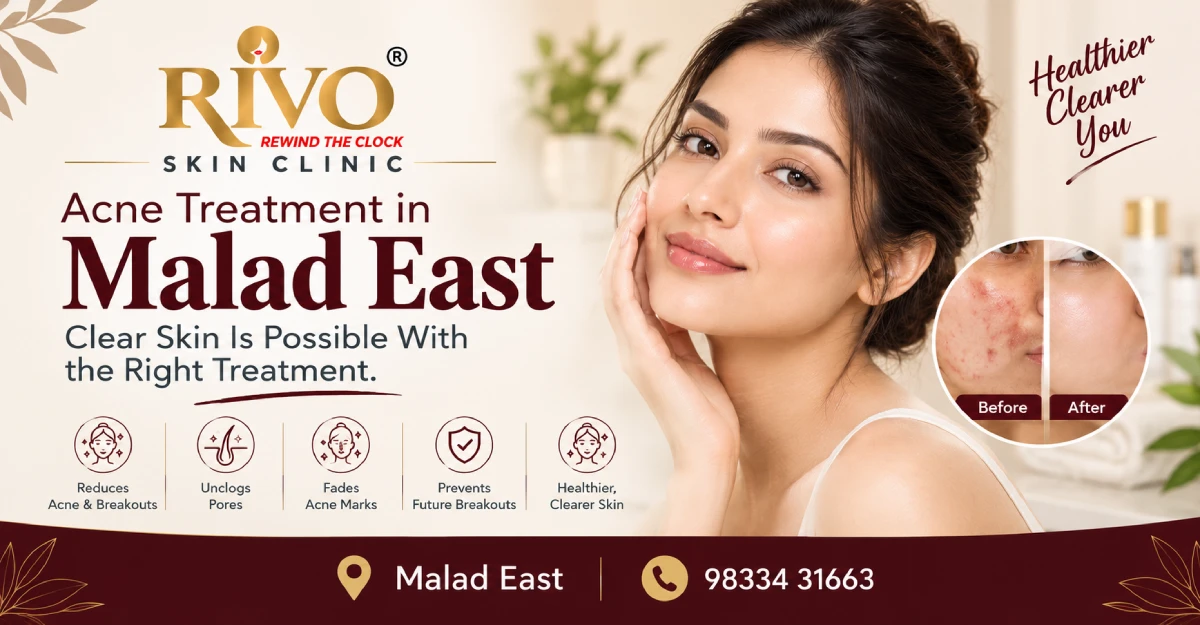 acne treatment in malad east